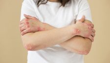 Penyakit autoimun dapat menyerang siapa saja, tetapi perempuan memiliki risiko yang jauh lebih tinggi dibandingkan laki-laki.