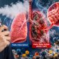 Bahaya Vape bagi Paru-paru.(Foto:Yudi/pilar)